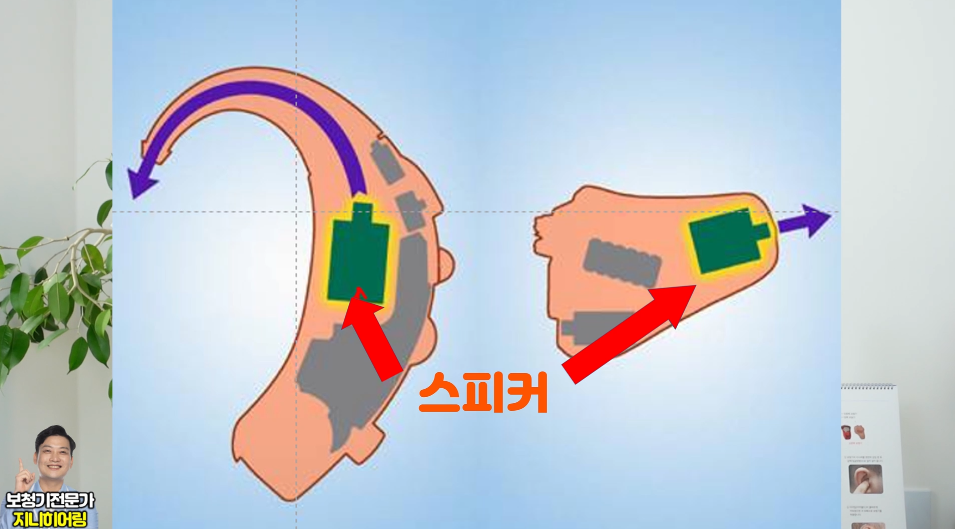 RIC 보청기 단점 원문 이미지 4
