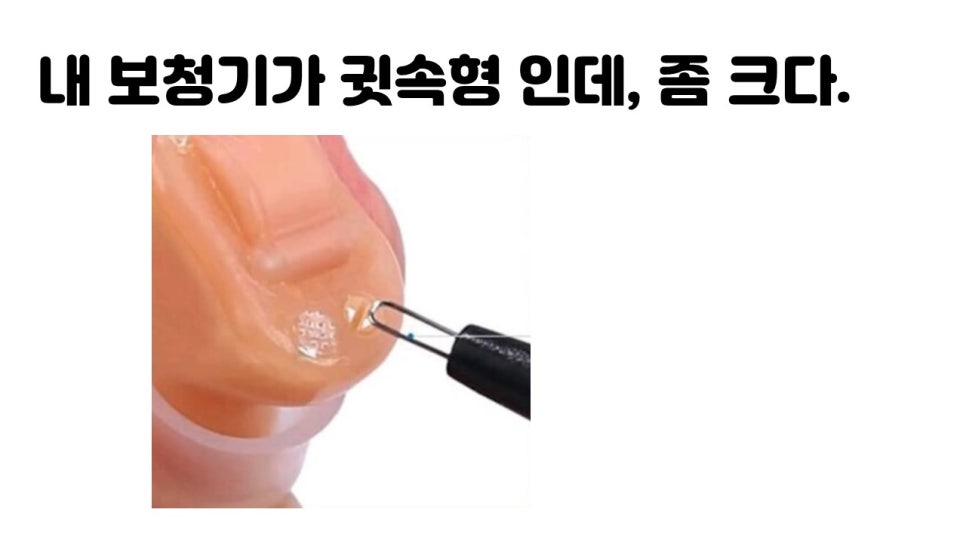 보청기 볼륨 조정 원문 이미지 20