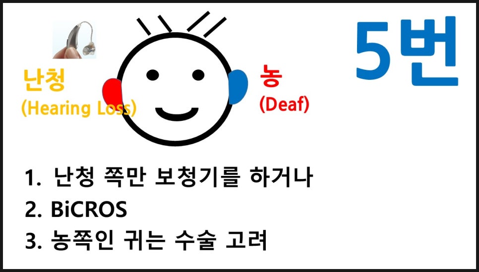 보청기 한쪽귀 양쪽귀 원문 이미지 11