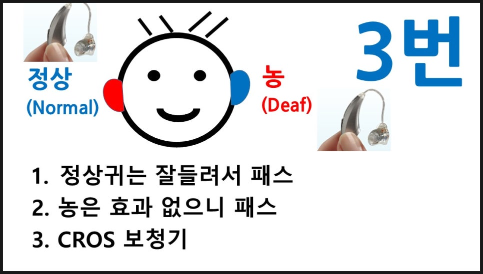 보청기 한쪽귀 양쪽귀 원문 이미지 8